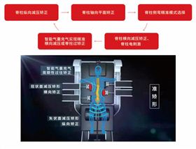 外星舱三维脊柱减压矫形系统