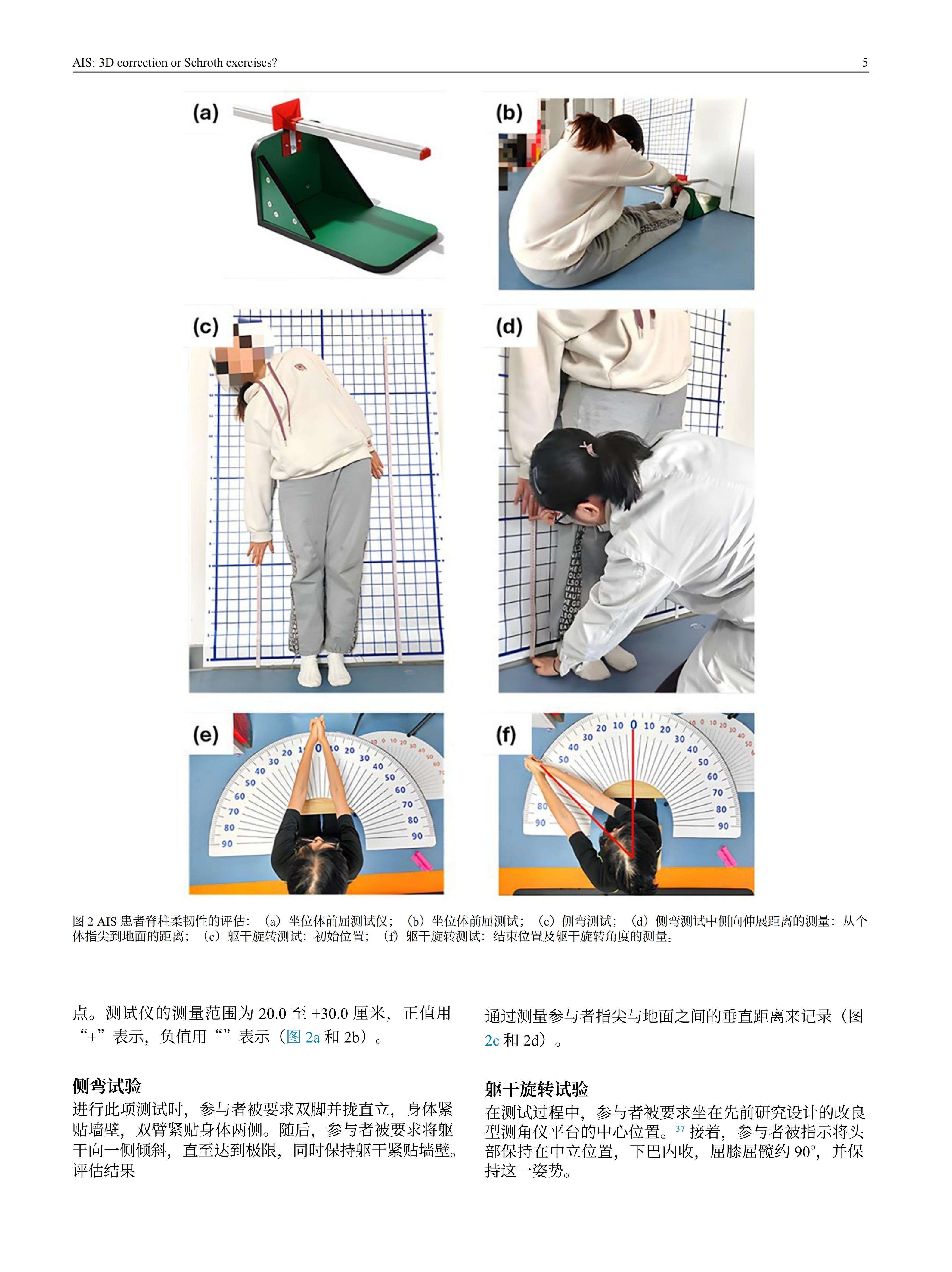 青少年特发性脊柱侧弯患者采用先进机械三维脊柱侧弯矫正方案的效果